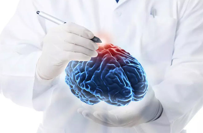 Neurosurgery Blog Image